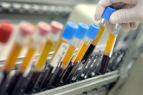 دوپینگ در بسکتبال؛ بازیکن لیگ برتری ۲ سال محروم شد