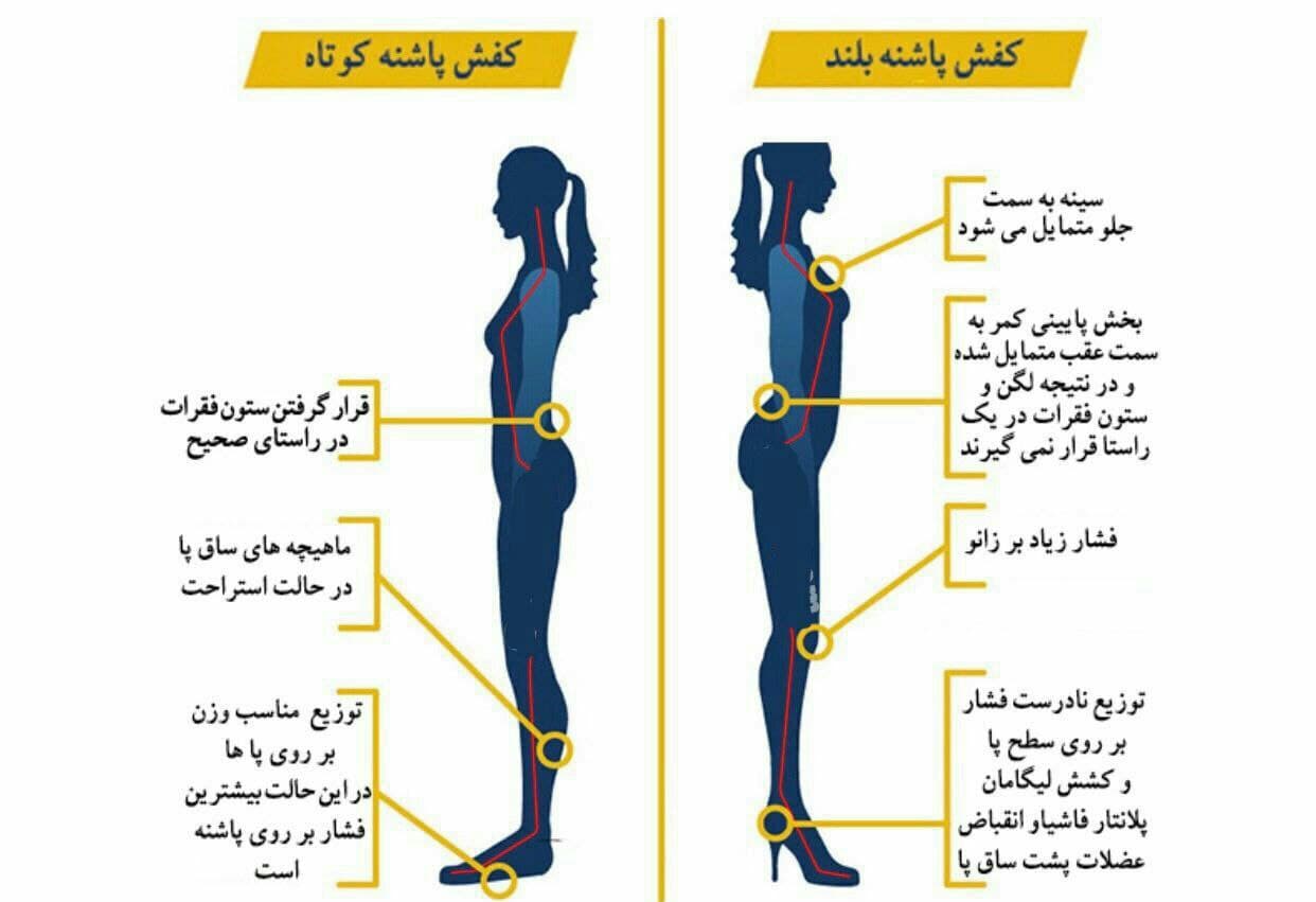کفش مناسب بپوشید