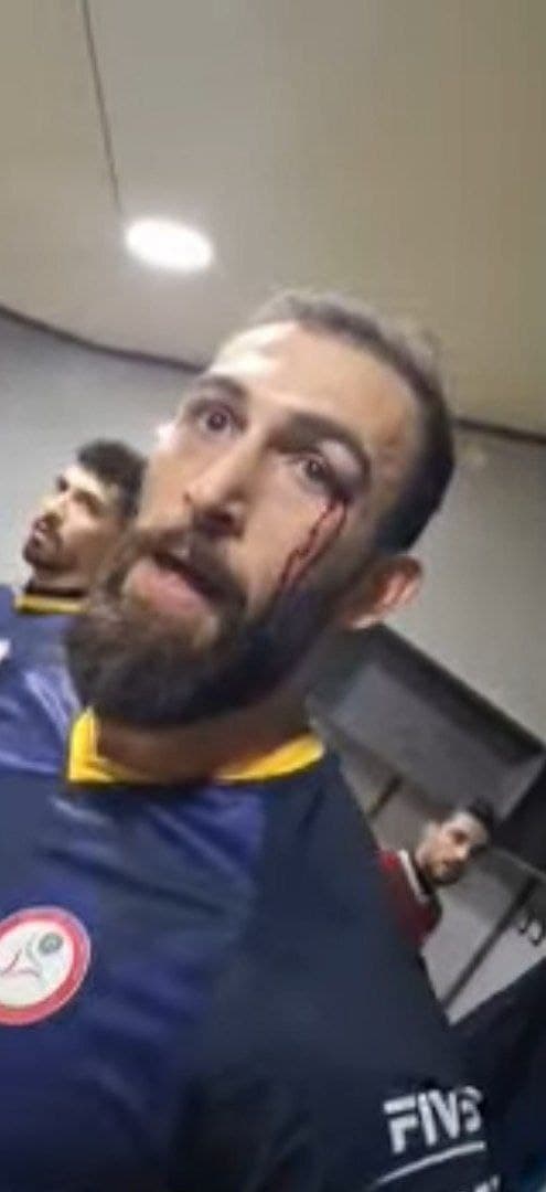 حمله گرگانی ها به بازیکنان شهرداری ارومیه 