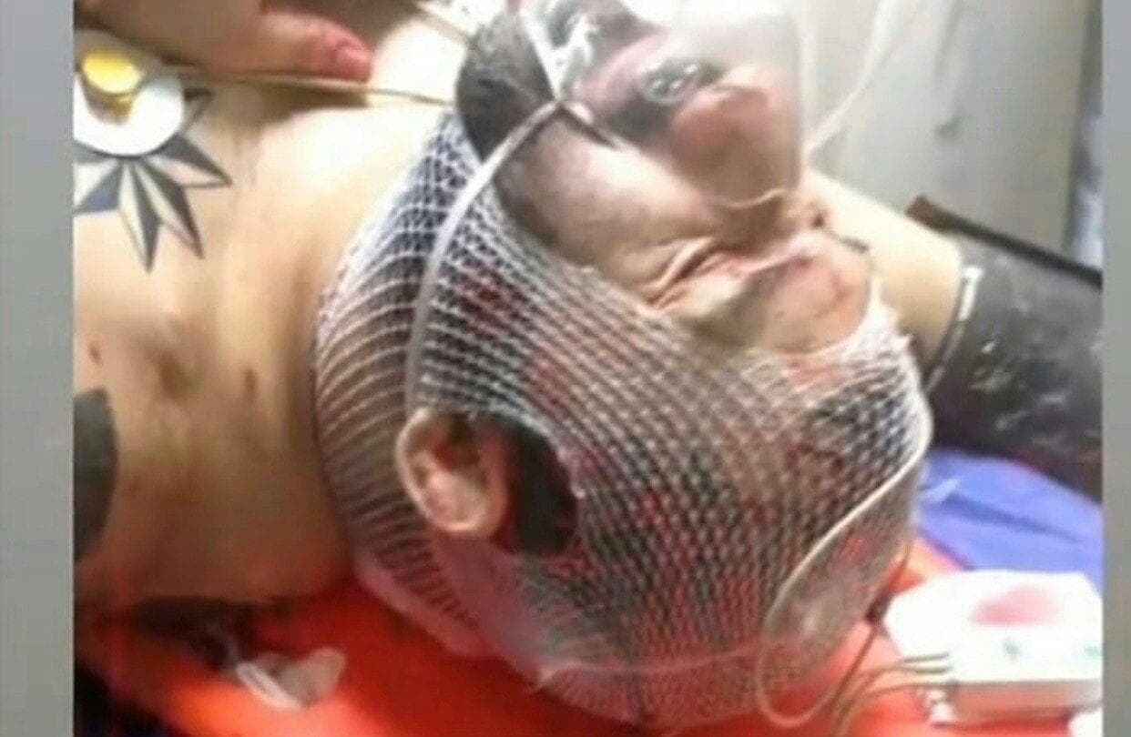 هانی کرده مورد اصابت ضربات چاقو قرار گرفت (عکس و ویدئو)