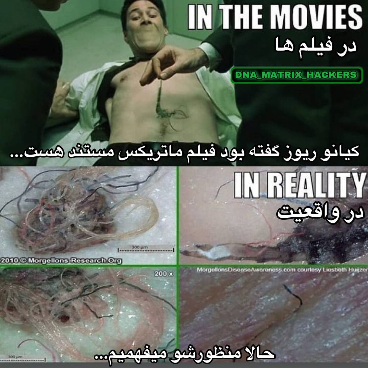 مورجلون ها morgellons در فیلم سینمایی ماتریکس